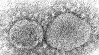 Coronavirus origins still a mystery 3 years into pandemic